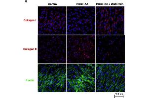 Immunofluorescence (Cultured Cells) (IF (cc)) image for anti-Collagen, Type III, alpha 1 (COL3A1) (C-Term) antibody (ABIN2856819)