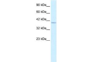 WB Suggested Anti-PTK2B Antibody Titration:  0.