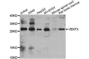 Western blot analysis of extracts of various cell lines, using VENTX antibody. (VENTX 抗体)