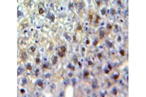 Used in DAB staining on fromalin fixed paraffin-embedded Liver tissue (CEBPG 抗体  (AA 1-150))