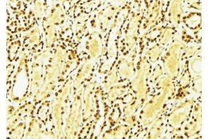 ABIN6274265 at 1/100 staining Mouse kidney tissue by IHC-P. (CK1 epsilon 抗体  (Internal Region))