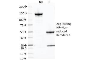 SDS-PAGE Analysis Purified CD71 Mouse Monoclonal Antibody (66IG10). (Transferrin Receptor 抗体)