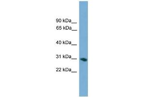 WB Suggested Anti-FCN1 Antibody Titration: 0. (FCN1 抗体  (Middle Region))