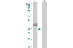 Western Blot analysis of LOC619207 expression in transfected 293T cell line by LOC619207 MaxPab polyclonal antibody. (SCART1 抗体  (AA 1-232))