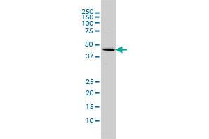 FBXO25 monoclonal antibody (M01), clone 2F1 Western Blot analysis of FBXO25 expression in COLO 320 HSR . (FBXO25 抗体  (AA 1-367))