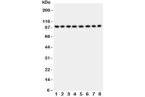 Western blot testing of CD10 antibody and Lane 1:  rat kidney;  2: (r) brain;  3: (r) liver;  4: human placenta;  5: (h) HeLa;  6: (h) Jurkat;  7: (h) Raji;  8: (h) 293T lysate;  Routinely visualized at ~100KD (MME 抗体  (AA 52-750))