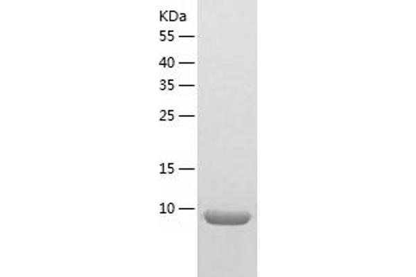 NDUFA2 Protein (AA 1-99) (His tag)