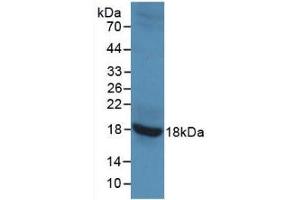 Detection of Recombinant GAD2, Rat using Monoclonal Antibody to Glutamate Decarboxylase 2 (GAD2) (GAD65 抗体)