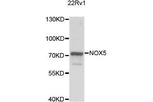Western blot analysis of extracts of 22Rv1 cells, using NOX5 antibody. (NOX5 抗体  (AA 661-765))