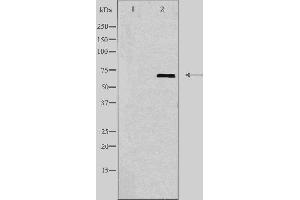 Western blot analysis of extracts from HUVEC cells, using GBP1 antibody. (GBP1 抗体  (C-Term))