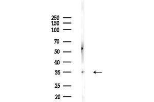 anti-Orthodenticle Homeobox 1 (OTX1) (Internal Region) antibody