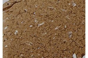 ABIN6266346 and ABIN6277205 at 1/100 staining Human brain tissue by IHC-P.