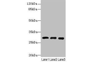 Western blot All lanes: CELA3A antibody at 14 μg/mL Lane 1: Mouse heart tissue Lane 2: Mouse skeletal muscle tissue Lane 3: Jurkat whole cell lysate Secondary Goat polyclonal to rabbit IgG at 1/10000 dilution Predicted band size: 30 kDa Observed band size: 30 kDa (Elastase 3A 抗体  (AA 29-270))