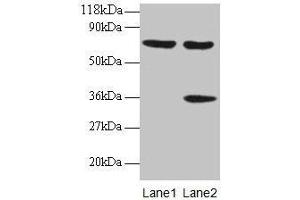 Western blot All lanes: SYNCRIP antibody at 2 μg/mL Lane 1: EC109 whole cell lysate Lane 2: 293T whole cell lysate Secondary Goat polyclonal to rabbit IgG at 1/15000 dilution Predicted band size: 70, 66, 63, 59, 47 kDa Observed band size: 70, 36 kDa (SYNCRIP 抗体  (AA 2-191))