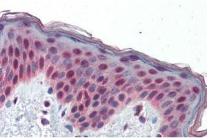 Immunohistochemistry (Paraffin-embedded Sections) (IHC (p)) image for anti-Transcription Factor 7-Like 1 (T-Cell Specific, HMG-Box) (TCF7L1) (AA 35-84) antibody (ABIN6741527)