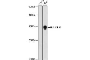 Western blot analysis of extracts of various cell lines, using HLA-DRB1 antibody (ABIN7268374) at 1:1000 dilution.
