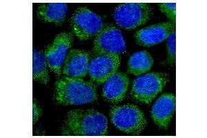 IF analysis of NOV/CCN3 using anti-NOV/CCN3 antibody (ABIN5518938).
