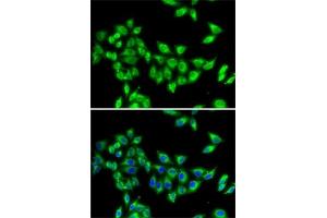 Immunofluorescence analysis of MCF7 cells using KIF3A antibody (ABIN6128170, ABIN6142871, ABIN6142872 and ABIN6222335). (KIF3A 抗体  (AA 430-699))