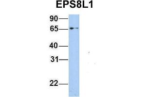 Host:  Rabbit  Target Name:  EPS8L1  Sample Type:  293T  Antibody Dilution:  1. (EPS8-Like 1 抗体  (Middle Region))
