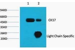 Immunoprecipitation (IP) analysis: 1) Input: HeLa Cell Lysate. (KRT17 抗体)