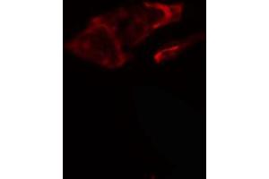 Immunofluorescence (fixed cells) (IF/ICC) image for anti-Collagen, Type V, alpha 1 (COL5A1) (N-Term) antibody (ABIN6260948)