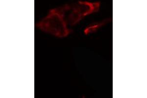 ABIN6266880 staining HeLa cells by IF/ICC. (COL5A1 抗体  (N-Term))