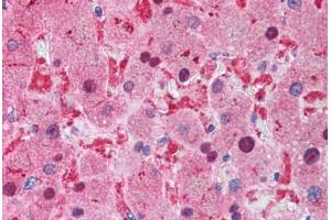 Human Liver (formalin-fixed, paraffin-embedded) stained with XIAP antibody ABIN214586 at 2 ug/ml followed by biotinylated goat anti-rabbit IgG secondary antibody ABIN481713, alkaline phosphatase-streptavidin and chromogen. (XIAP 抗体  (C-Term))