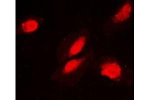 Immunofluorescent analysis of FKBP3 staining in MCF7 cells. (FKBP3 抗体)