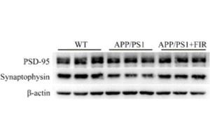 Western blot analysis of PSD-95 and synaptophysin protein in the hippocampus region of AD mice.