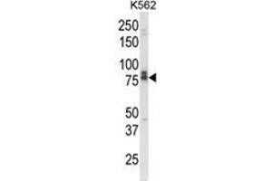 Western blot analysis of IL18RAP Antibody (N-term) in K562 cell line lysates (35ug/lane). (IL18RAP 抗体  (N-Term))