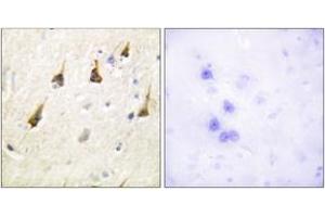 Immunohistochemistry analysis of paraffin-embedded human brain tissue, using SENP7 Antibody. (SENP7 抗体  (AA 991-1040))
