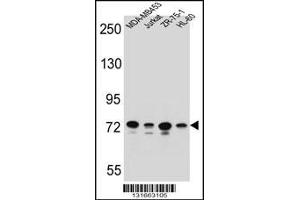 Western blot analysis in MDA-MB453,Jurkat,ZR-75-1,HL-60 cell line lysates (35ug/lane). (PCDHB15 抗体  (N-Term))