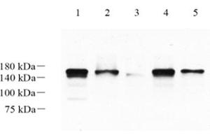 Western blot analysis of LRIG1 (ABIN7074488),at dilution of 1: 1000,Lane 1: Mouse brain tissue lysate,Lane 2: Mouse cerebellum tissue lysate,Lane 3: Mouse skin tissue lysate,Lane 4: Rat brain tissue lysate,Lane 5: Rat cerebellum tissue lysate (Lrig1 抗体)