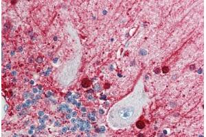 Human Brain, Cerebellum (formalin-fixed, paraffin-embedded) stained with CASP5 antibody ABIN214433 at 5 ug/ml followed by biotinylated goat anti-rabbit IgG secondary antibody ABIN481713, alkaline phosphatase-streptavidin and chromogen. (CASP5 抗体)