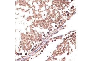 Immunohistochemistry (IHC) image for anti-Barrier To Autointegration Factor 1 (BANF1) antibody (ABIN7265826)