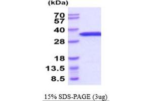 Eukaryotic Translation Initiation Factor 4E (EIF4E) (AA 1-217) protein (His tag)