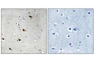 Immunohistochemical analysis of paraffin-embedded human brain tissue using E2A (Phospho-Thr355) antibody (left)or the same antibody preincubated with blocking peptide (right). (TCF3 抗体  (pThr355))