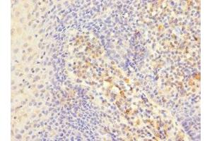 Immunohistochemistry of paraffin-embedded human tonsil tissue using ABIN7156455 at dilution of 1:100 (CD103 抗体  (AA 19-200))