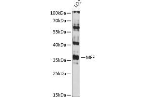 Western blot analysis of extracts of LO2 cells, using MFF antibody (ABIN6132274, ABIN6143787, ABIN6143789 and ABIN6216008) at 1:3000 dilution. (MFF 抗体  (AA 15-170))