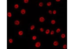ABIN6266647 staining 293 by IF/ICC. (SAE1 抗体  (Internal Region))