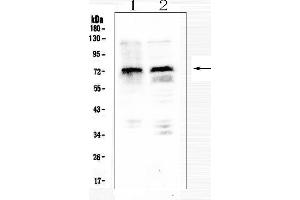 Western blot analysis of MID1 using anti-MID1 antibody (ABIN6719400).