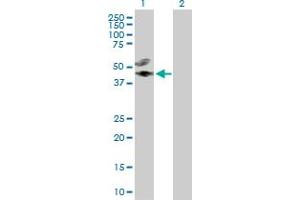 Western Blot analysis of CREB3L4 expression in transfected 293T cell line by CREB3L4 MaxPab polyclonal antibody. (CREB3L4 抗体  (AA 1-395))