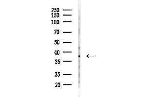 Western blot analysis of lysates from K562 cells(UV 30 min treatment), using BC Antibody at 1/1000 dilution.