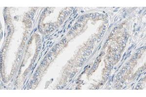 ABIN6269292 at 1/100 staining Human prostate tissue by IHC-P. (Calmodulin 1 抗体)