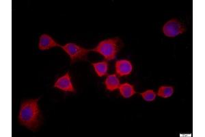 HEK 293 stained with Rad51 Polyclonal Antibody, Unconjugated  at 1:500 in PBS and incubated for one hour at room temperature, followed by secondary antibody incubation, DAPI staining of the nuclei and detection. (RAD51 抗体  (AA 81-180))