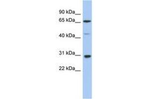 Image no. 1 for anti-Protein Inhibitor of Activated STAT, 3 (PIAS3) (AA 395-444) antibody (ABIN6742316)