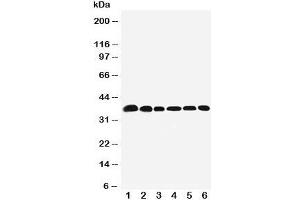 Western blot testing of Nucleophosmin antibody and Lane 1:  rat testis;  2: (r) brain;  3: human HeLa;  4: (h) U87;  5: (h)A549;  6: (h) SMMC-7721 cell lysate. (NPM1 抗体  (N-Term))