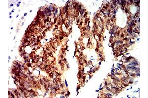 Immunohistochemistry (IHC) image for anti-Catenin (Cadherin-Associated Protein), beta 1, 88kDa (CTNNB1) (AA 1-100) antibody (ABIN5611272)