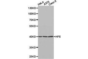 Western Blotting (WB) image for anti-Hemochromatosis (HFE) antibody (ABIN1872964) (HFE 抗体)