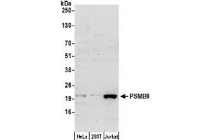 Western Blotting (WB) image for anti-Proteasome (Prosome, Macropain) Subunit, beta Type, 8 (Large Multifunctional Peptidase 7) (PSMB8) (AA 125-175) antibody (ABIN7452962)